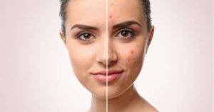 هل يعاني جسمك من نقص الفيتامينات؟ هذه أهم العلامات