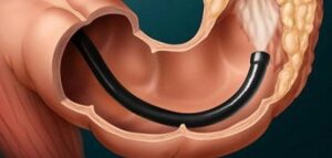 أسهل الطرق لطرد السموم وتنشيط الهضم