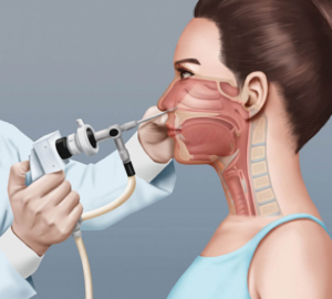 لماذا يلتهب الجيوب الأنفية؟ 7 أسباب شائعة وعلاجات منزلية سريعة