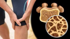 نقص النحاس علاماته وكيف تعالجها بالتغذية