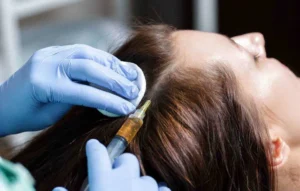 التهابات فروة الرأس: أنواعها الشائعة وعلاجاتها الفعالة