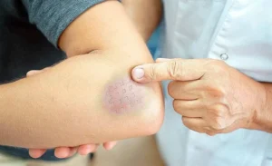 هل يعاني جسمك من نقص الفيتامينات؟ هذه أهم العلامات