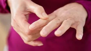 الروماتويد: أسبابه الخفية وطرق السيطرة عليه