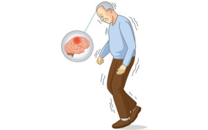 نقص النحاس علاماته وكيف تعالجها بالتغذية