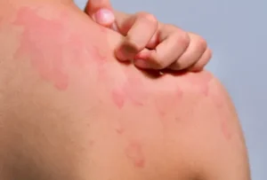 فوائد الزنك السحرية: دليل شامل لتعزيز المناعة وصحة البشرة