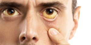 كيف يتخلص الكبد من الدهون وكم يستغرق الأمر