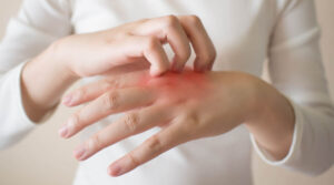 استخدامات زيت شجرة الشاي التي لا تعرفينها من قبل