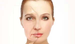 خيوط الذهب للوجه: التقنية الحديثة للبشرة المشدودة