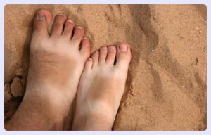 أفضل الطرق الطبيعية والطبية لاستعادة لون بشرتك الموحد