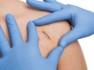 فوائد الزنك السحرية: دليل شامل لتعزيز المناعة وصحة البشرة