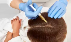 هل تُعتبر بلازما الشعر الحل النهائي لمشكلة الفراغات