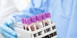 8 أطعمة ممنوعة لمرضى الحساسية تُشعل الجلد في ساعات – تجنبيها اليوم