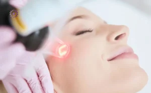 علاج البشرة بالليزر: 5 مشاكل يُزيلها في 3 جلسات