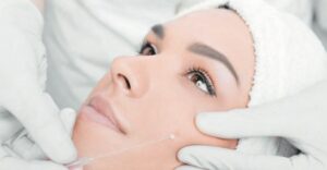 Thread lifting: The modern technique for taut skin